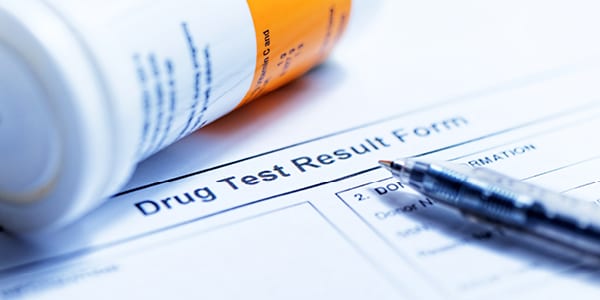 Random Drug Tests