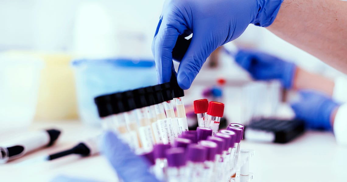 Lab Testing